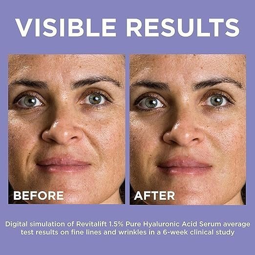 L'Oréal Paris Revitalift Derm Intensives 1.5% Pure Hyaluronic Acid Serum – 15ml - Image 3